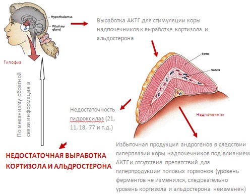 Патогенез адреногенитального синдрома