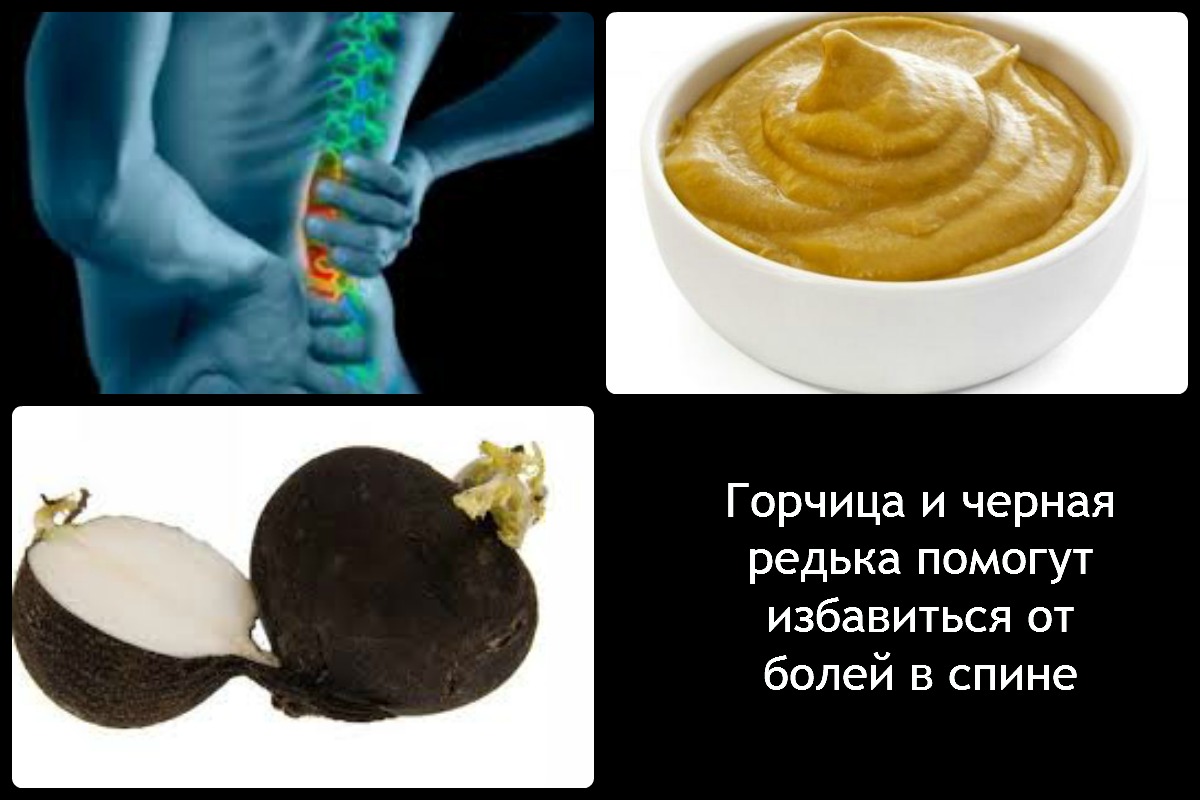 Лечение радикулита горчицей и черной редькой