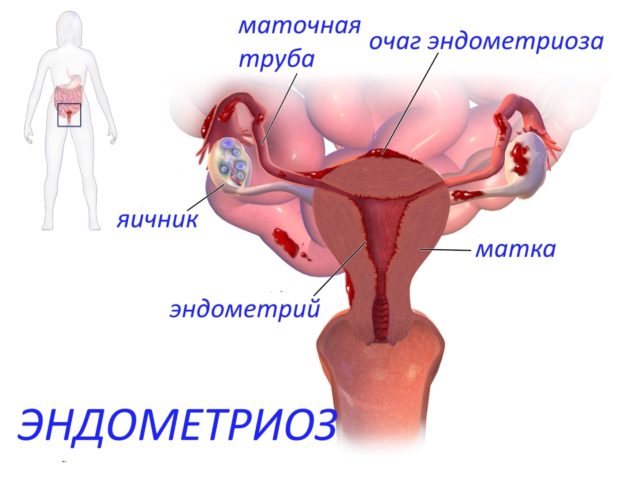 Месячные сразу после отмены визанны 1