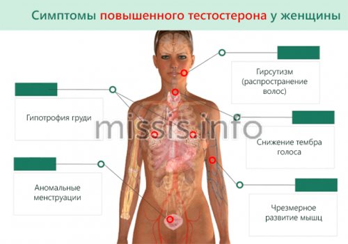 Признаки повышенного тестостерона