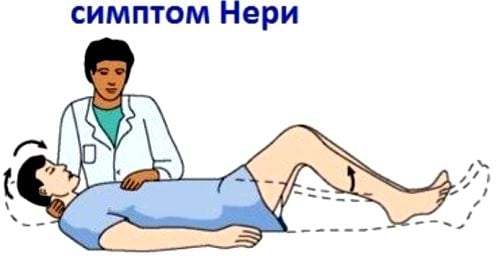 Что такое остеохондроз с корешковым синдромом
