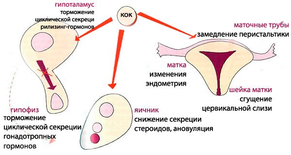 Жанин при миоме матки 2